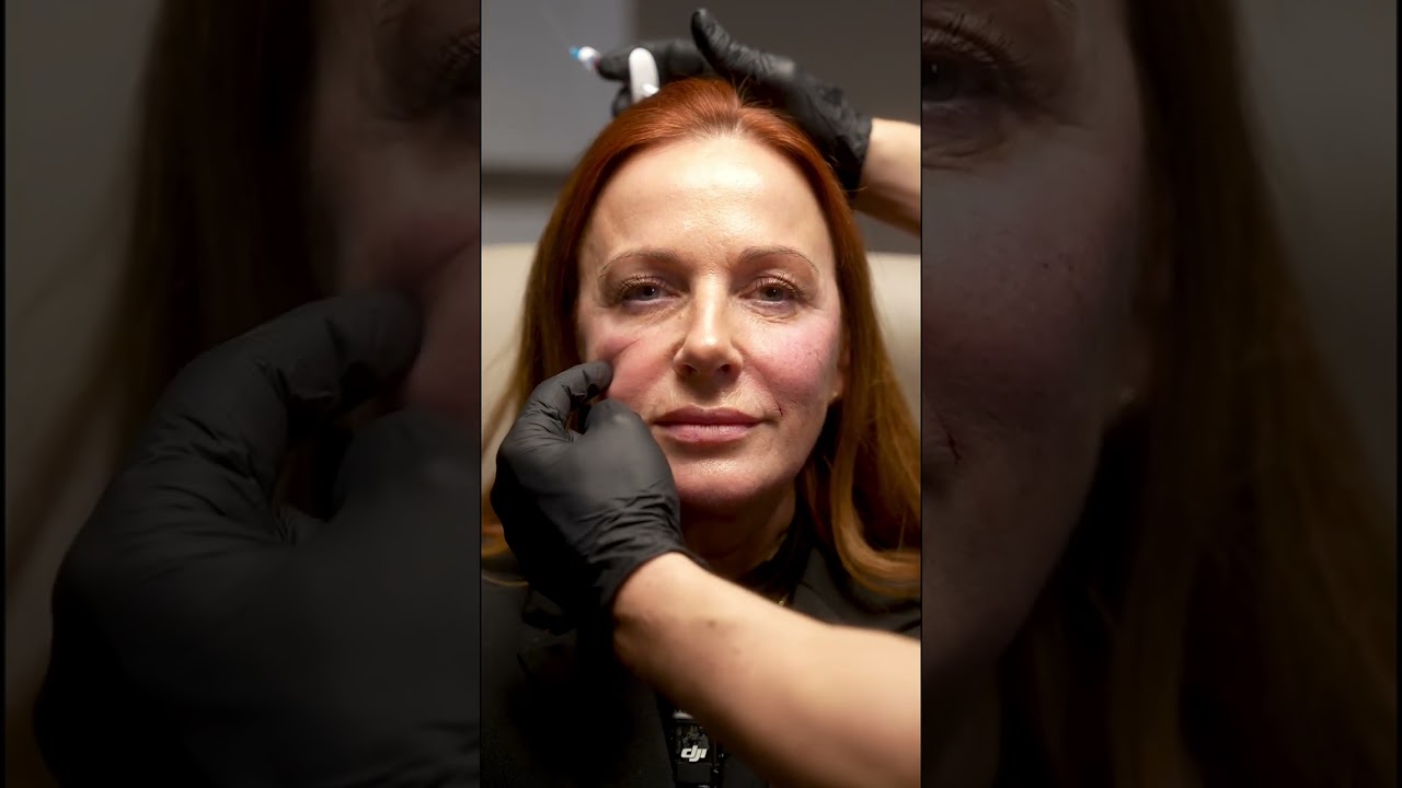 Liquid Facelift! 😳