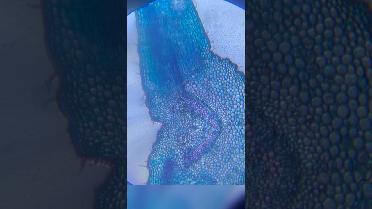Dicot leaf 🍃 under microscope 🔬 😮 