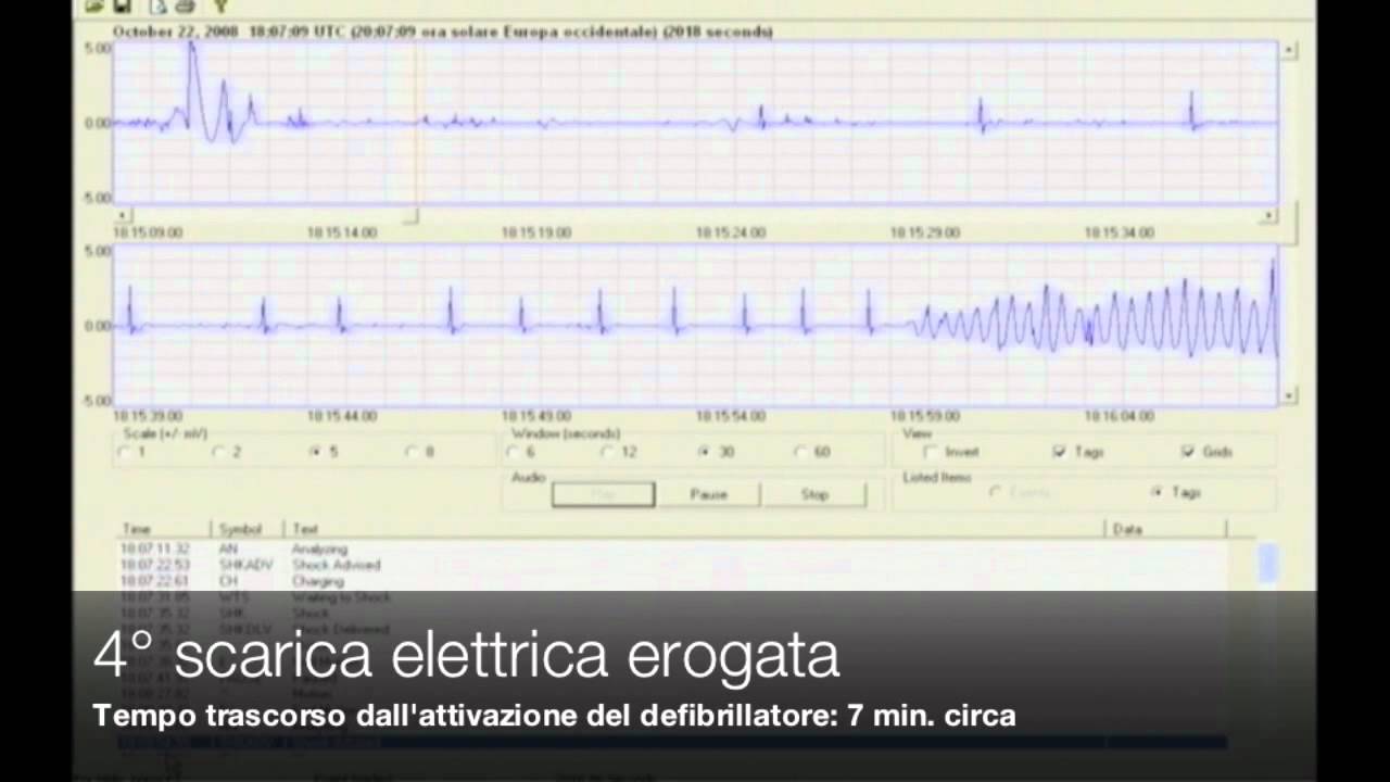 22 ottobre 2008 - Arresto cardiaco (soccorso reale)