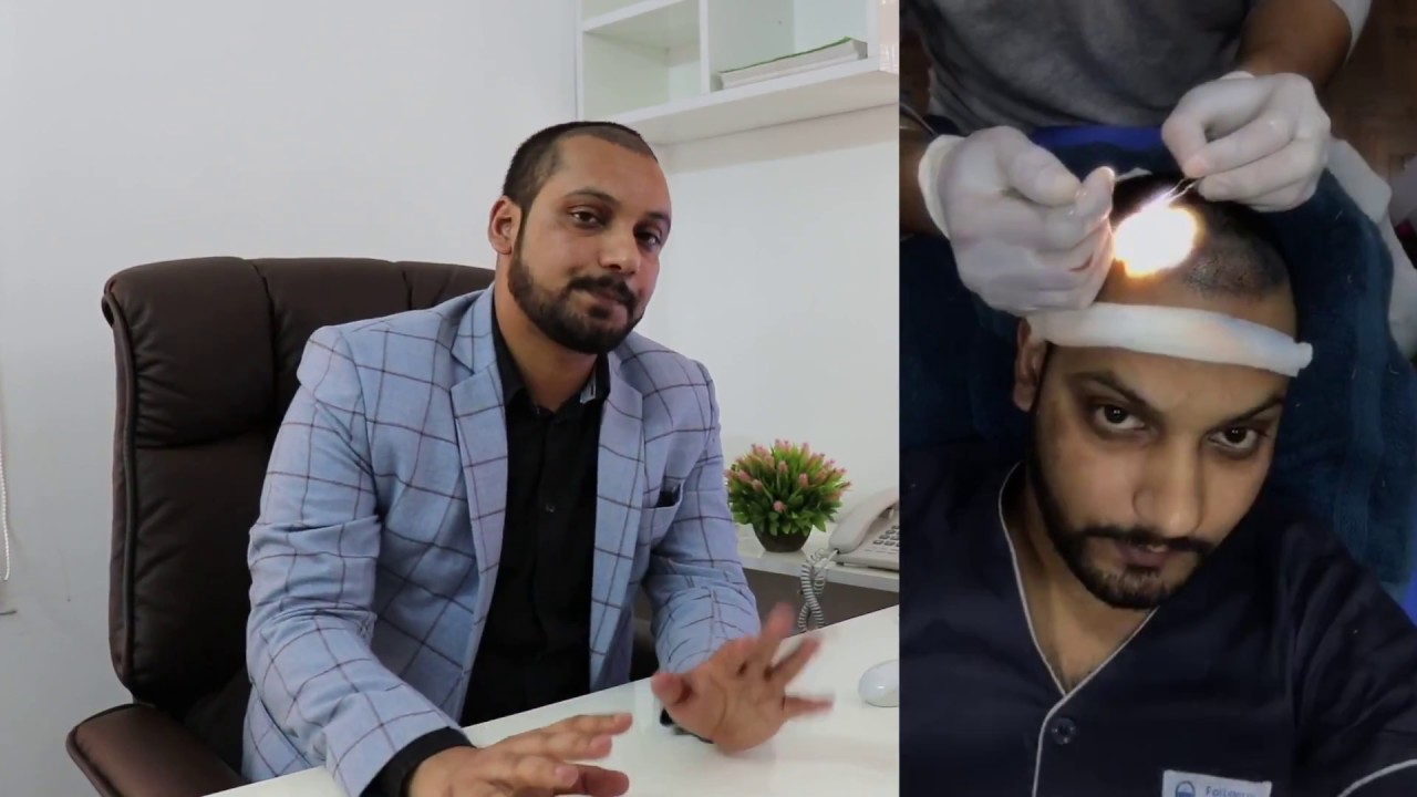 Best Care Tips After Hair Transplant, Hair Care Guide - Dr. Danish Anwar
