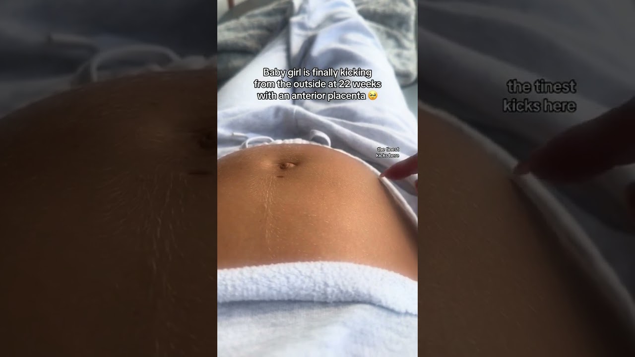 Baby girl is finally kicking from the outside at 22 weeks with an anterior placenta #twinpregnancy