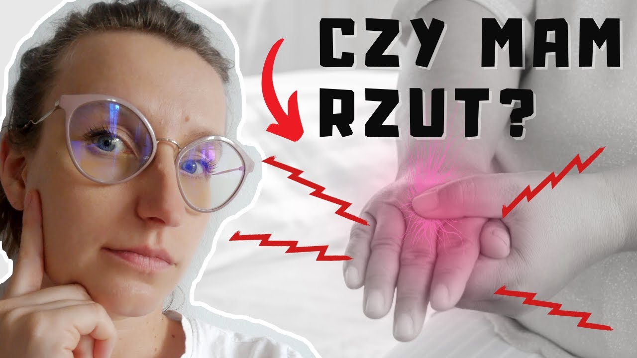 SM - jak rozpoznać rzut? Mrowienie dłoni, drętwienie ręki - czy to już rzut? CO DALEJ? | O, choroba!