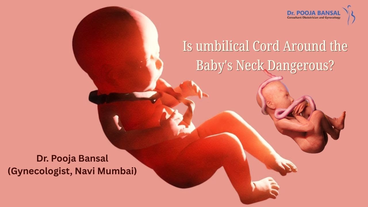 Is Cord Around the Baby's Neck Dangerous? | Dr. Pooja Bansal (Gynecologist, Navi Mumbai)