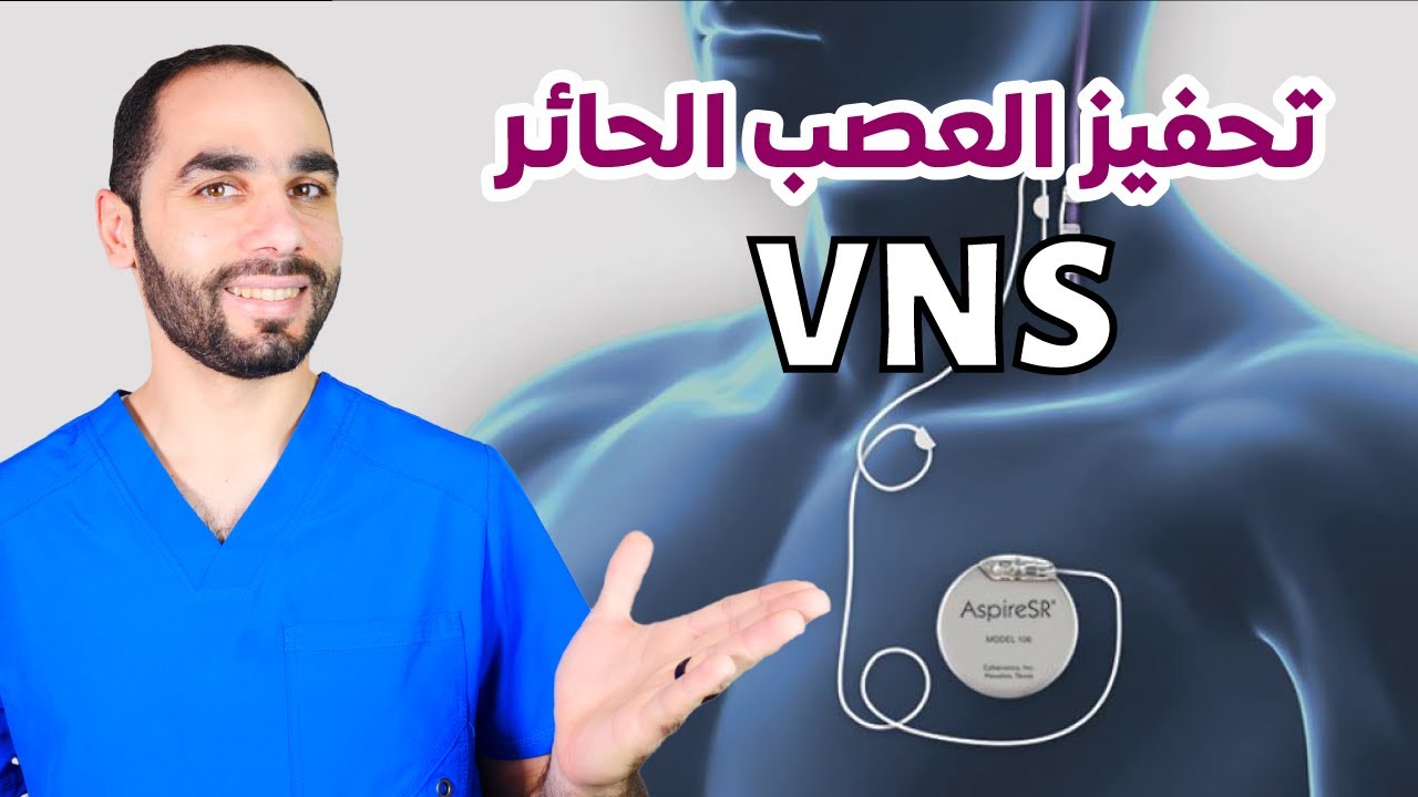 تحفيز العصب الحائر لعلاج الصرع
