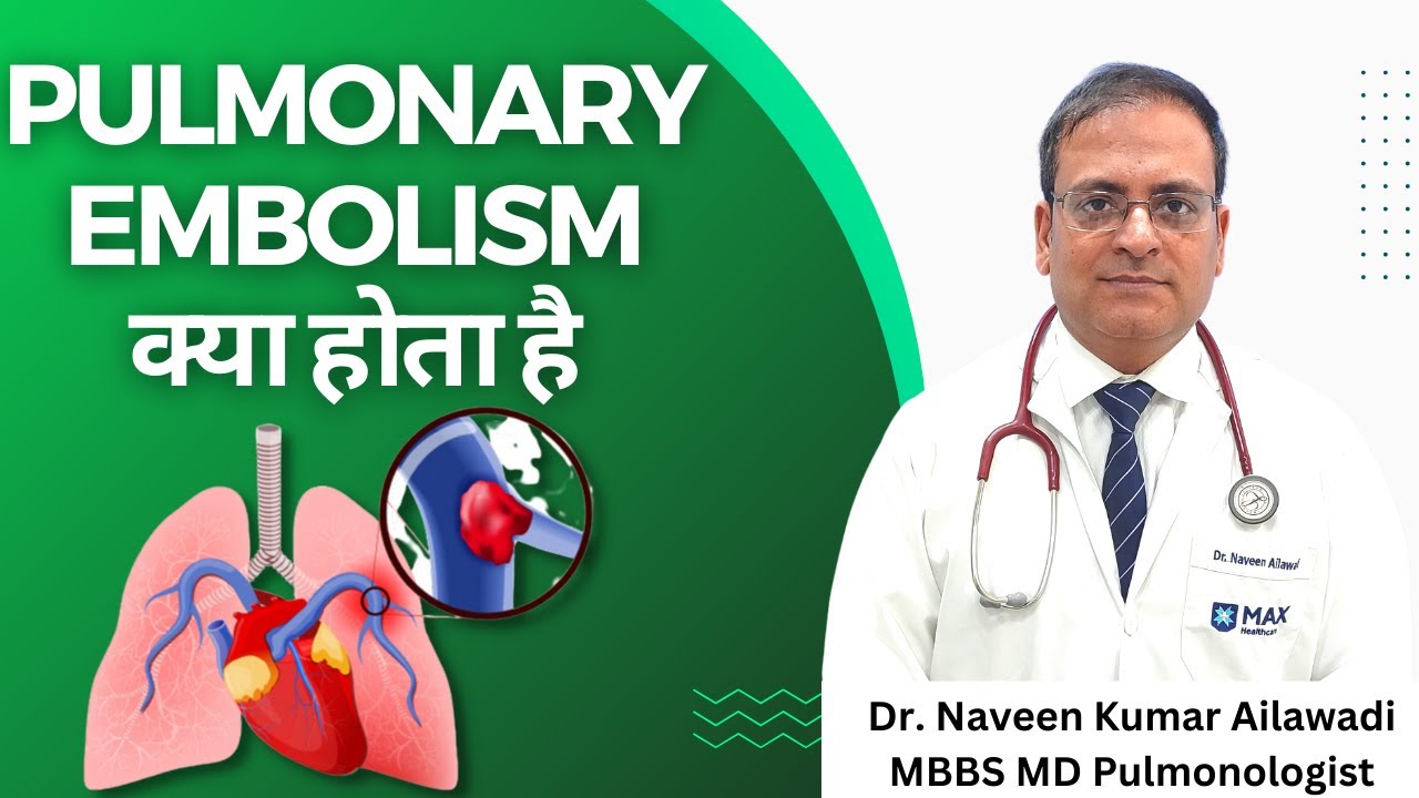 Pulmonary Embolism क्या होता है Causes Signs and Symptoms Diagnosis and Treatment #drnaveenailawadi