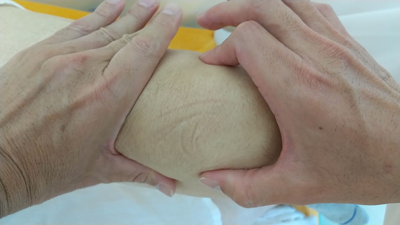 膝に水がたまった時の診かた対処法　春日部市　ときだ接骨院　鍼灸院　knee joint effusion