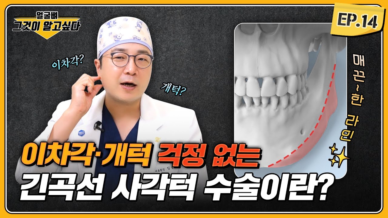 긴곡선 사각턱 수술이란?🎁 ｜얼굴뼈그알｜임종우 원장