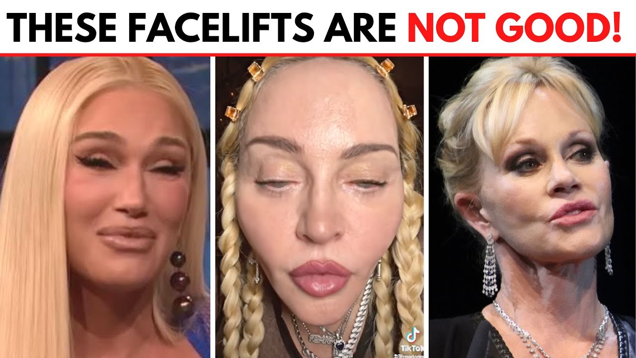 5 Popular Facelift Procedures to AVOID!