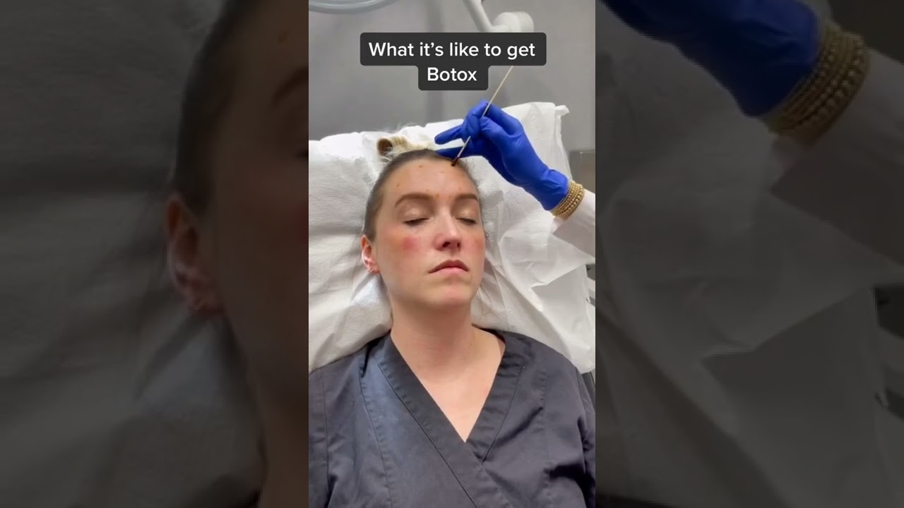 What It&rsquo;s Like Getting Botox