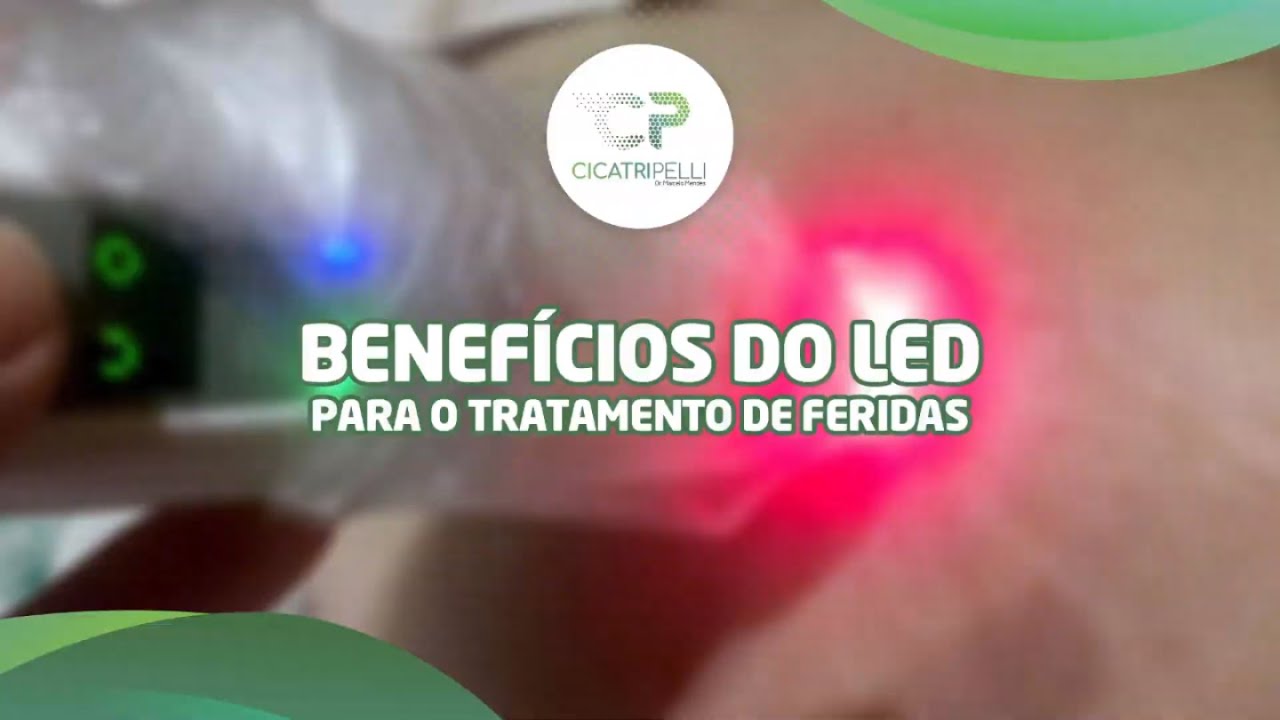 Ledterapia: conhe&ccedil;a um dos melhores tratamentos para feridas cr&ocirc;nicas
