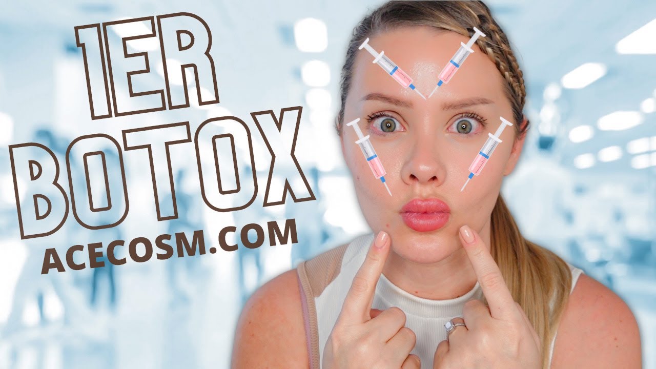 MA 1ERE EXPERIENCE AVEC LE BOTOX
