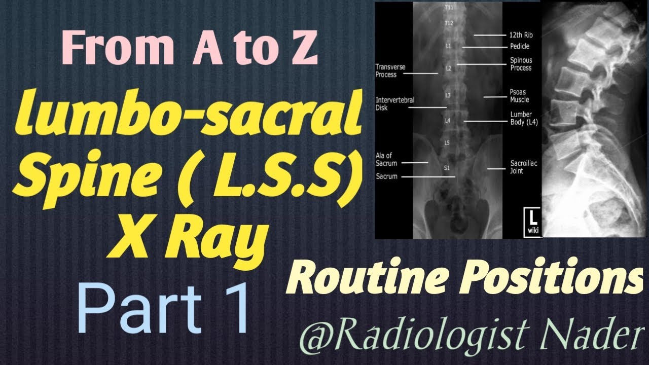 اشعة عادية علي الفقرات القطنية|الجزء1|تشريح|اوضاع|Lumbar Spine(L.S.S)X.Ray|Part1|Anatomy|Positions
