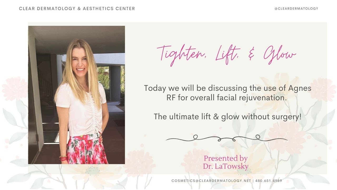 Tighten, Lift and Glow with Agnes RF
