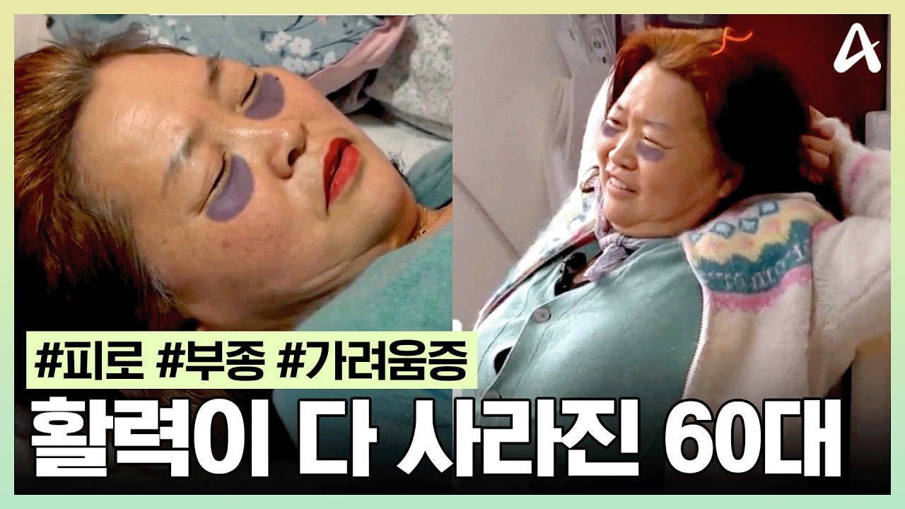 [#몸신의탄생] 종아리는 퉁퉁 붓고...🚨 매일매일이 너무 피곤하다?! 일상에 활력을 되찾아 줄 시크릿 비법은? | 몸신의 탄생 72회