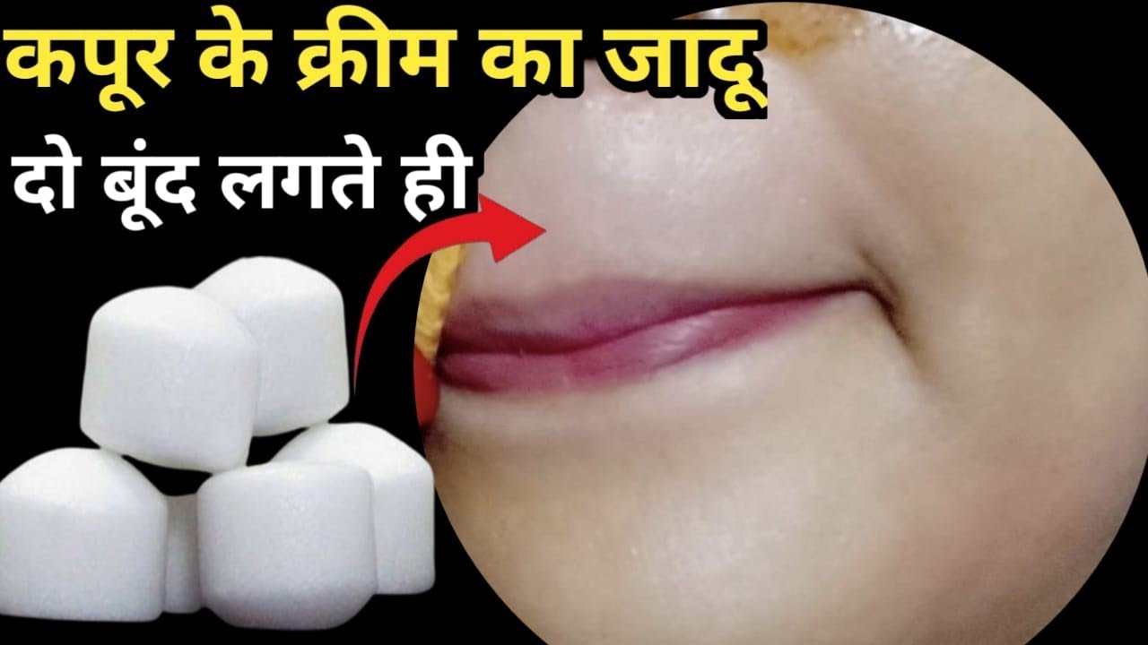 कपूर का क्रीम बनाकर👉दो बूंद लगते ही 68 साल आंटी के चेहरे से बाल बिना दर्द निकला हैरान😱| facial hair