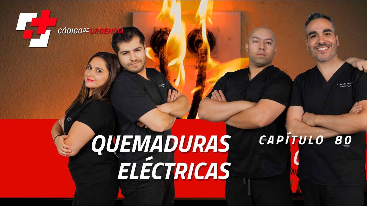 #80 Quemaduras eléctricas. ALTA TENSION, NO HAGAS ESTO.