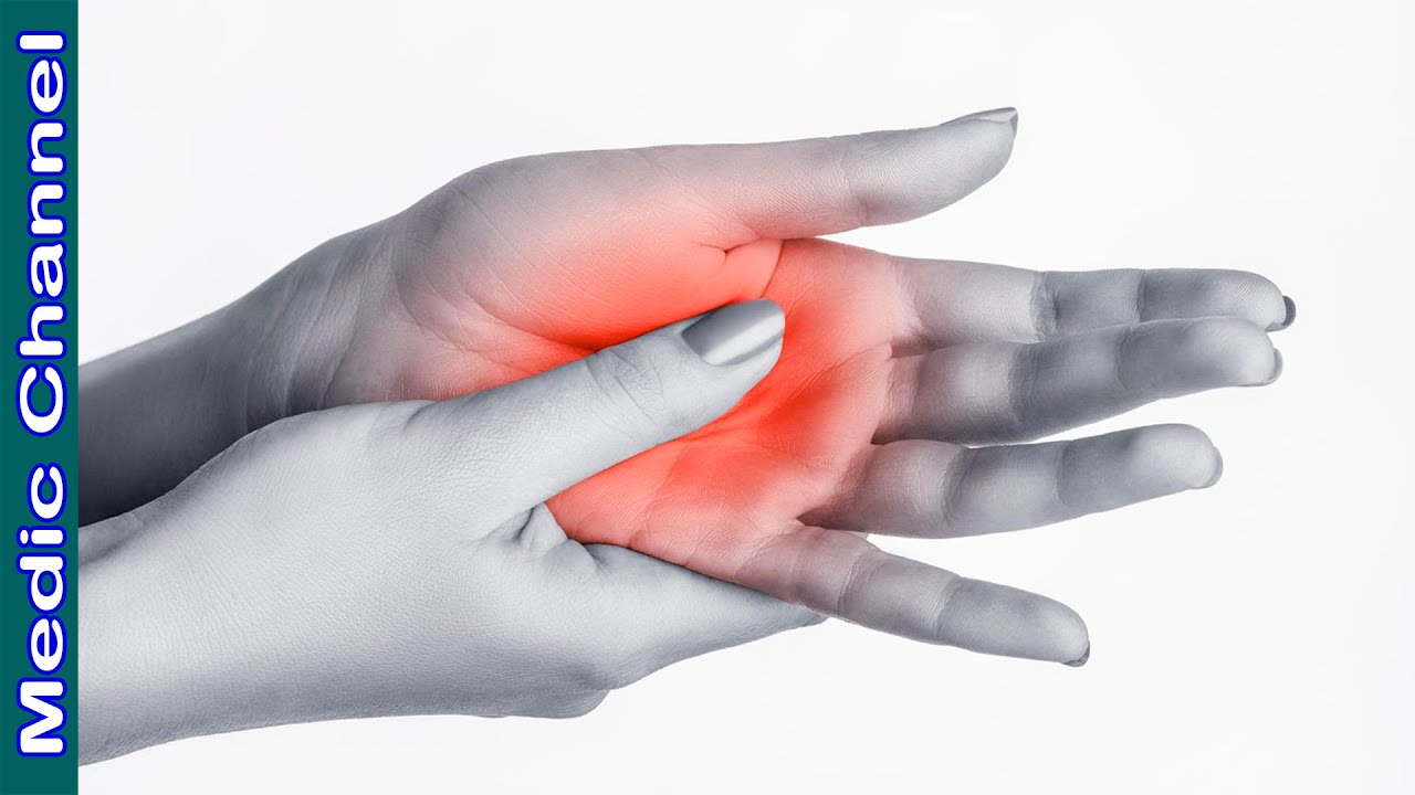 8 Se&ntilde;ales de tus manos que podr&iacute;an alertarte sobre tu salud