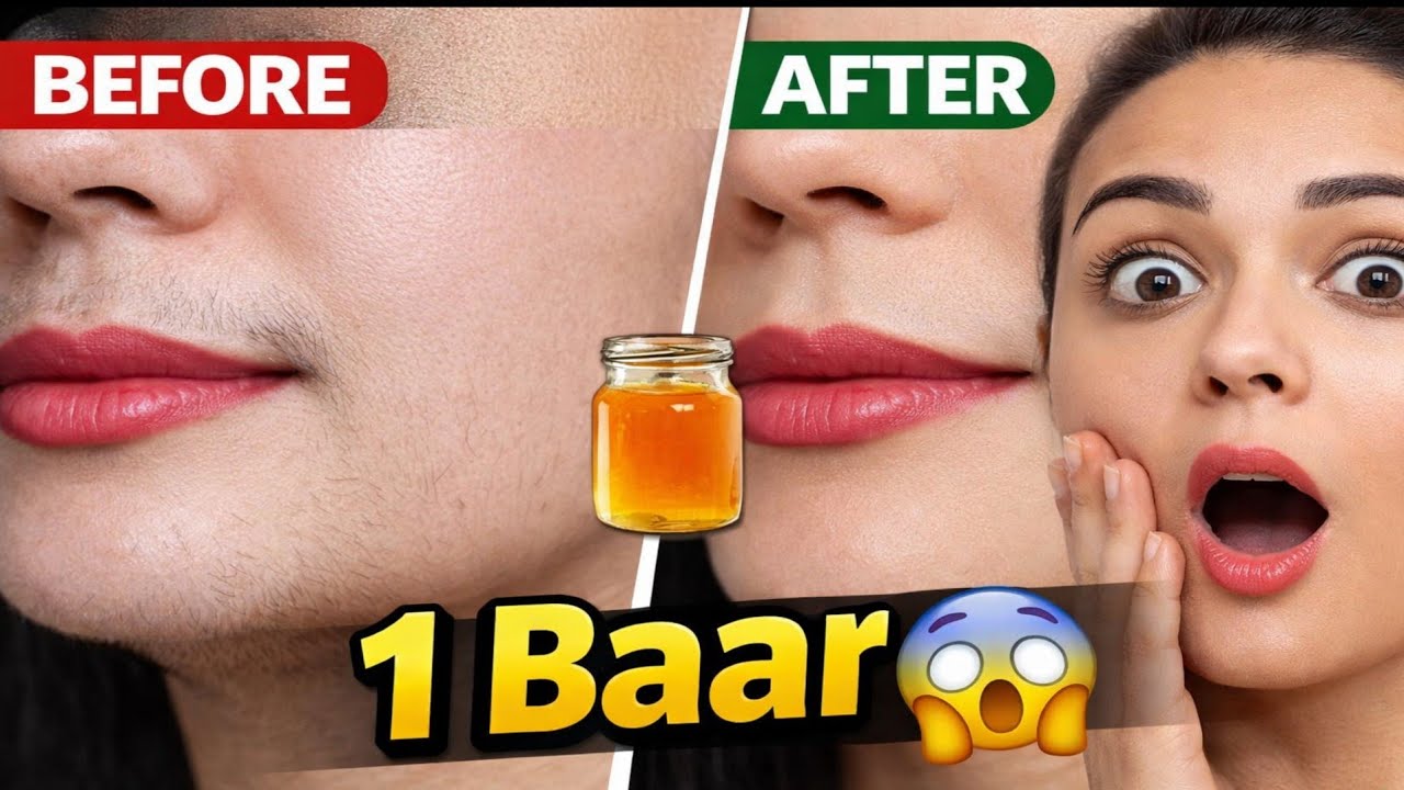 बाल जड़ से खत्म करने का देसी तरीका 😍 | 5 मिनट का कमाल ||remove facial hair naturally #viral 