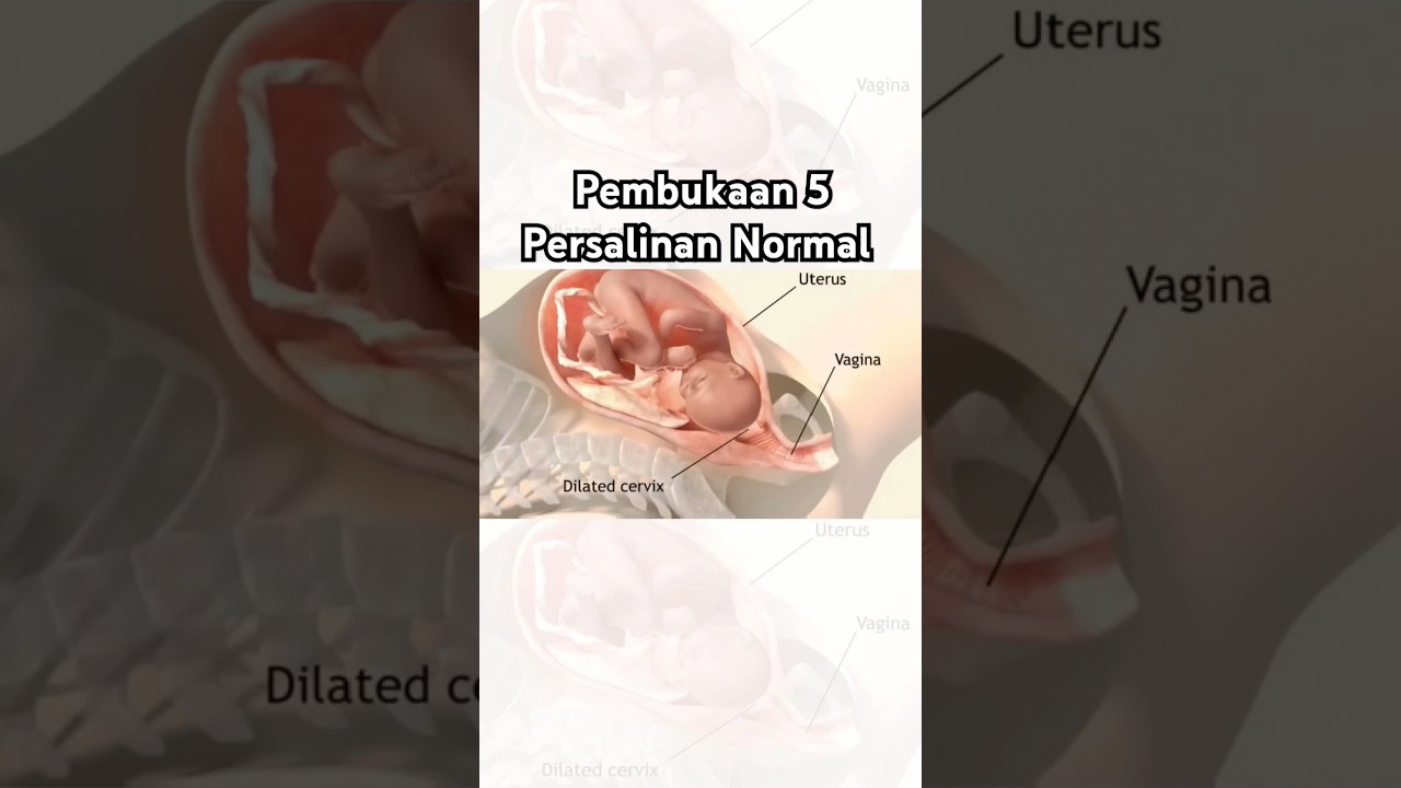 Pembukaan 5 Persalinan Normal