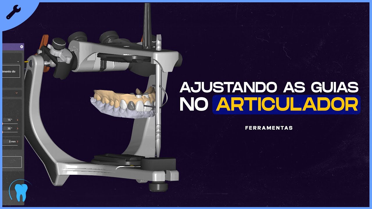 EXOCAD : Montagem no articulador virtual e ajuste de guias