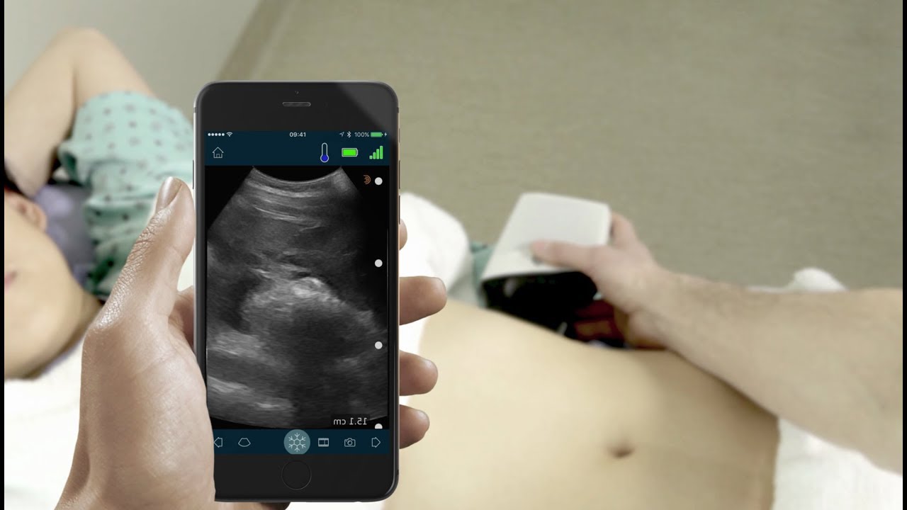 Mobile ultrasound for FASTer triage anywhere.