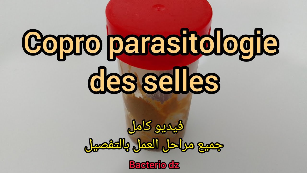 Copro parasitologie des selles ....فيديو كامل يشمل جميع المراحل بالتفصيل