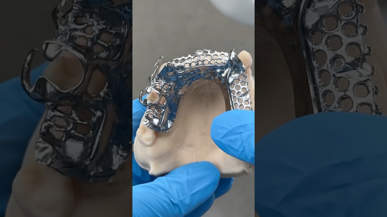 Chrome Cobalt Frameworks @EnvisiontecMain #envisiontec  #lsk121shorts #dentistry #teeth