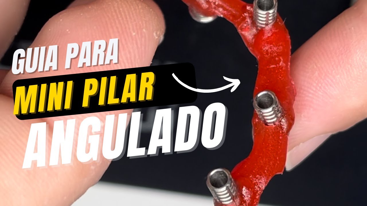 Guia Para Posicionar Mini Pilar