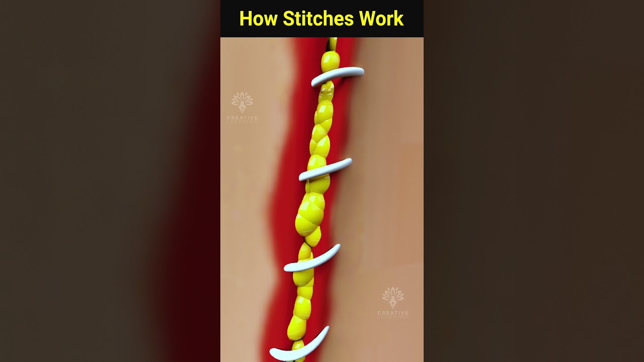 How wound stitches really work  #shorts #facts - Creativelearning3d