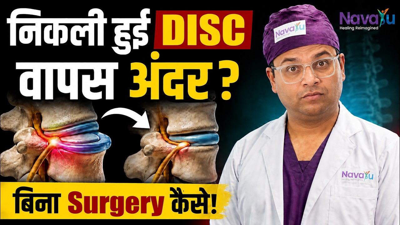 क्या निकली हुई डिस्क (Slip Disc) वापस डल सकती हैं? समझे इसका ईलाज डॉ सुनील सैनी से