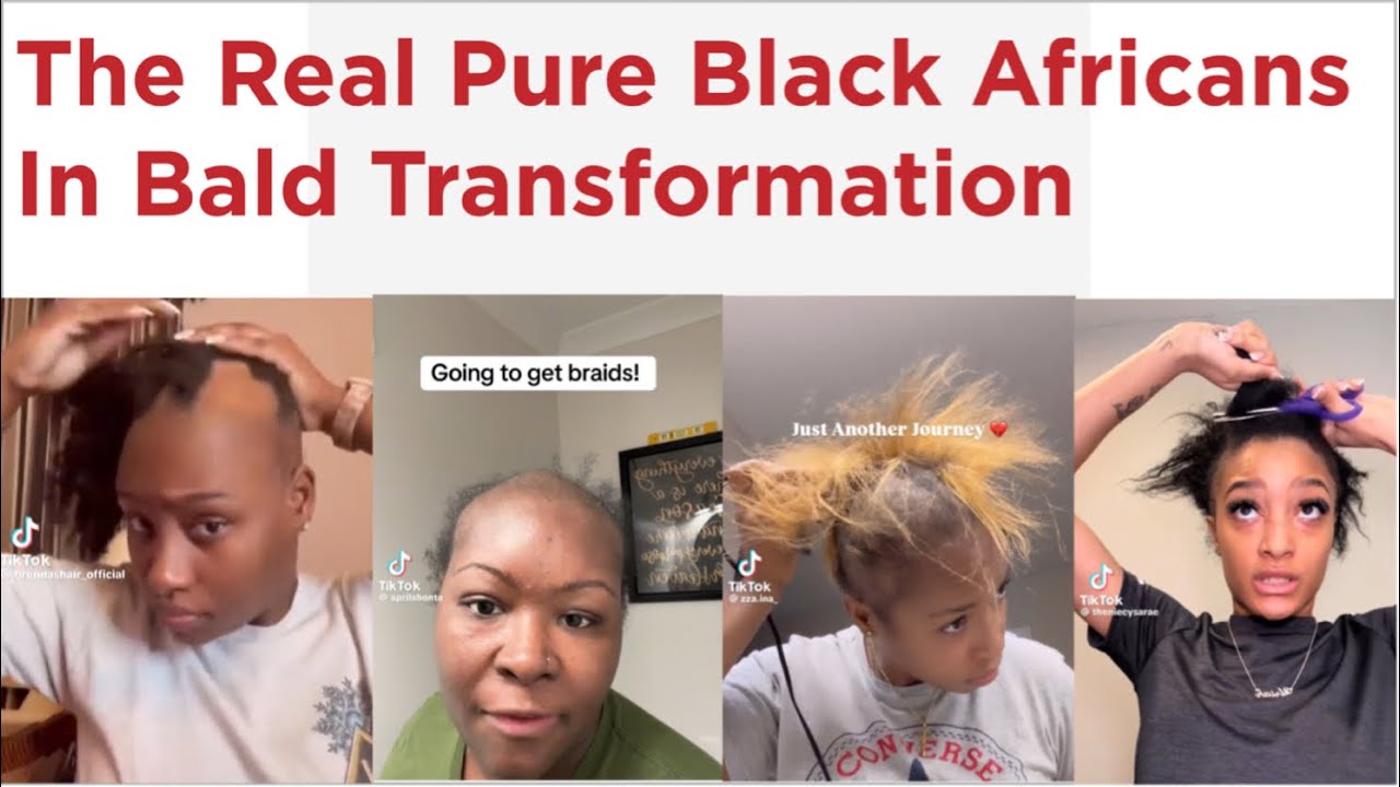 The Real Black African Women Going Bald || The transformation is Top notch
