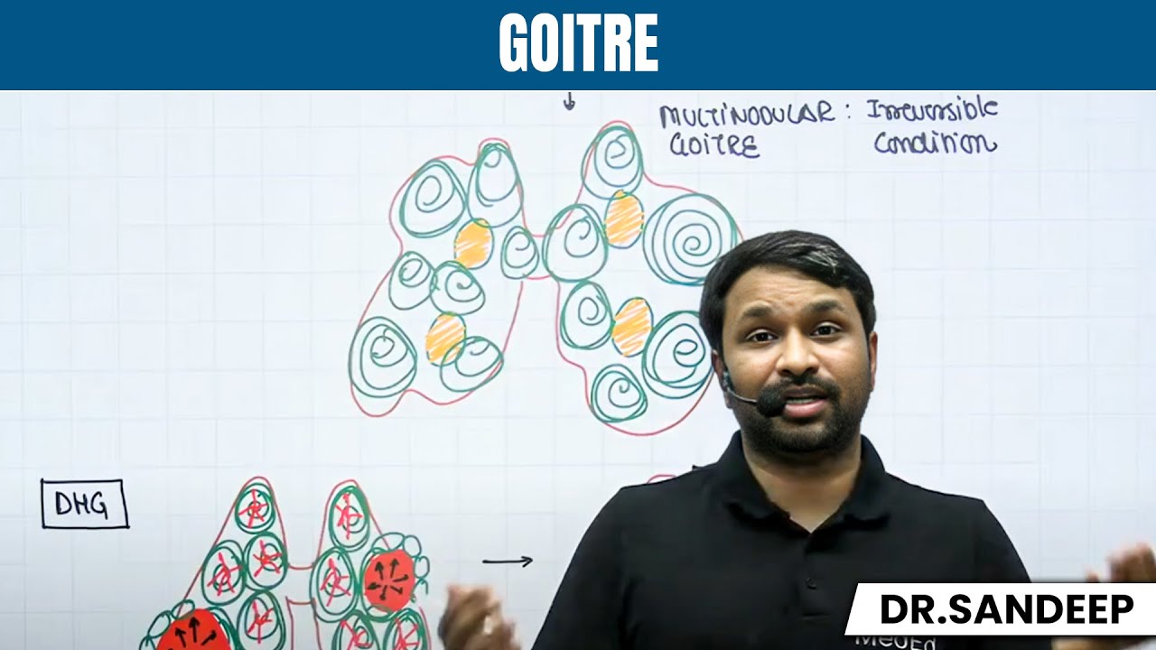 Goitre Surgery Lecture | Thyroid Swelling | Bailey learned with Dr. Sandeep (BLS) | PW MedEd