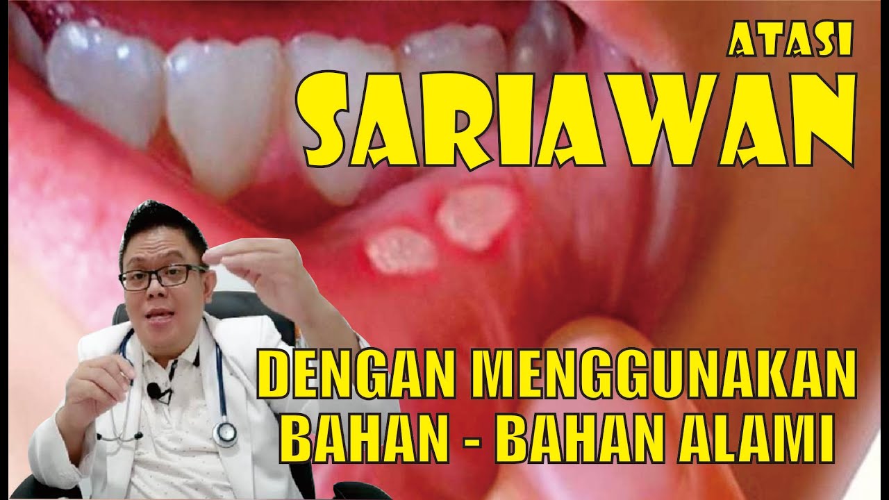SARIAWAN............ GUNAKAN BAHAN-BAHAN ALAMI INI UNTUK MENGATASINYA