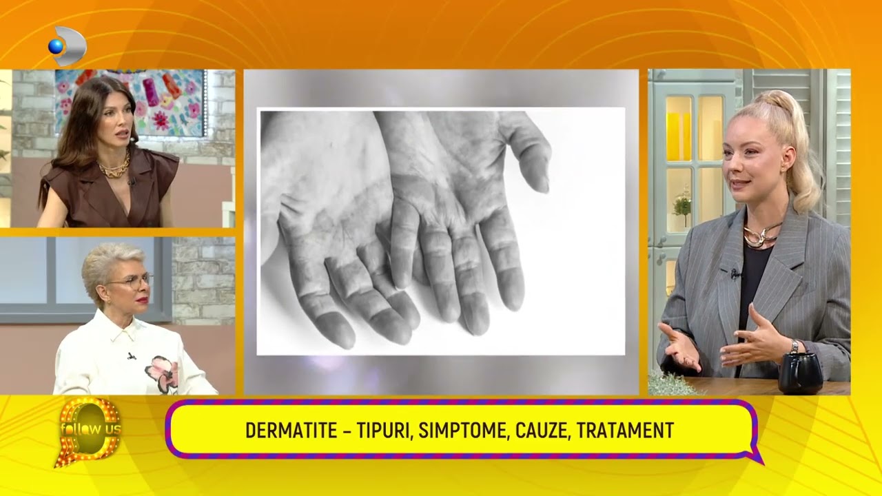 Follow us! - Psoriazis: cauze si simptome | Dermatite: tipuri, simptome, cauze si tratament