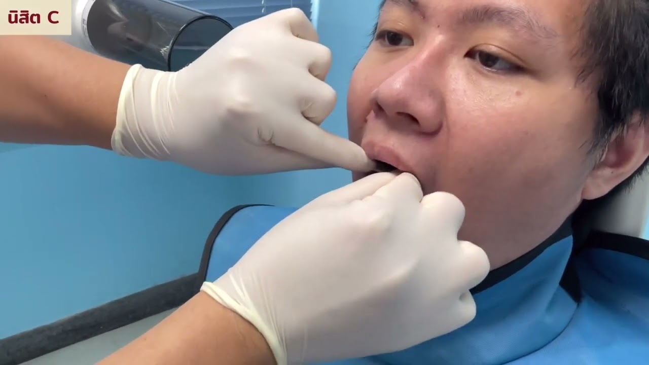 X-ray dentswu26
