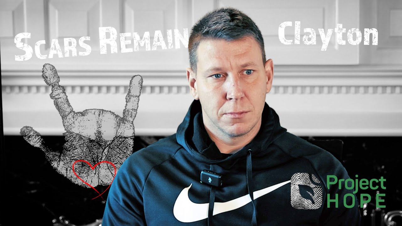 Scars Remain Ep. 1: Clayton’s Journey from Pain to Purpose