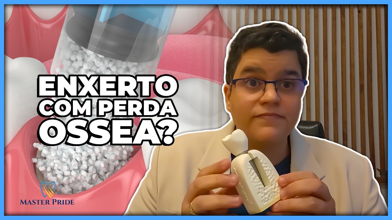 É possível fazer enxerto em dente que teve perda óssea?| Master Pride Odontologia | Dra Bianca Rosa