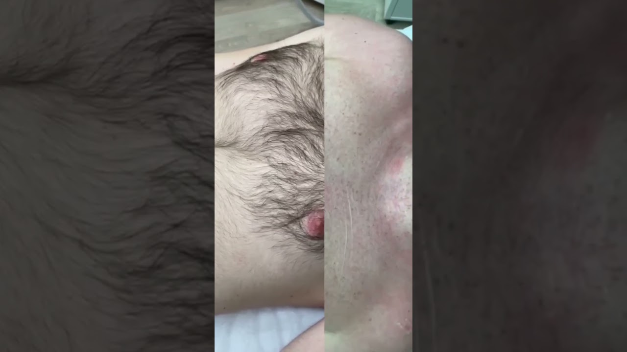 Мужская депиляция и эпиляция для мужчин зон живота и груди в студии депиляции Wax Bar в Екб
