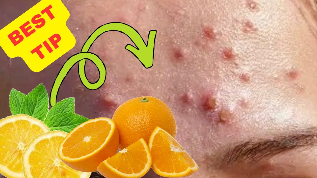 Lemon vs Orange for Skin Brightening
