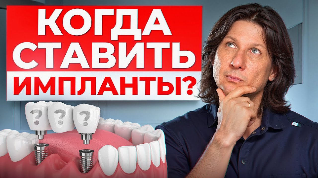 Почему зубы начинают ВЫПАДАТЬ? / 5 признаков, что вам срочно нужен имплант!