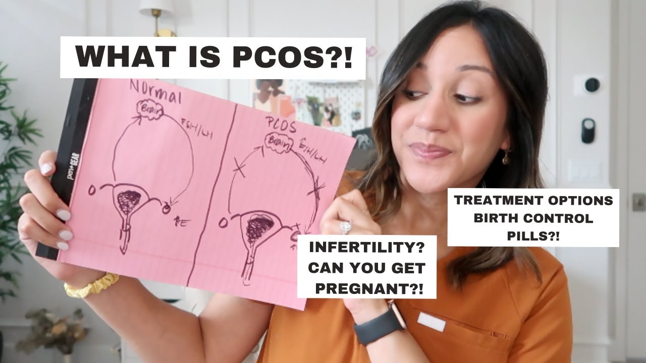 OBGYN explains PCOS | Dr. Ali