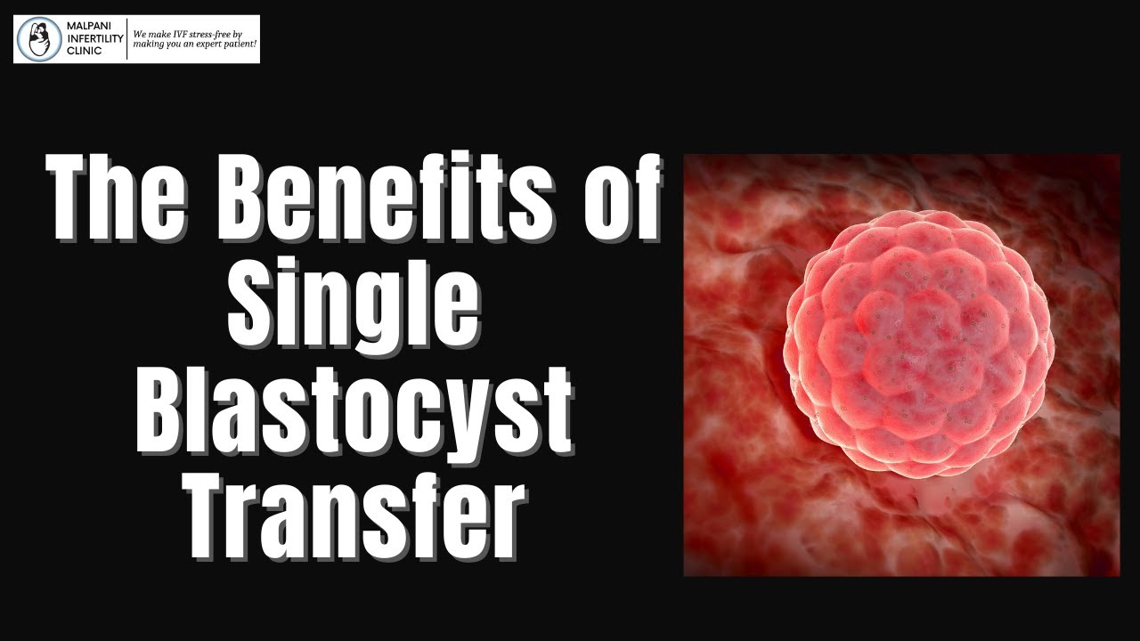 The Science behind Single Blastocyst Transfer for Increased Live Birth Rates | IVF Treatment