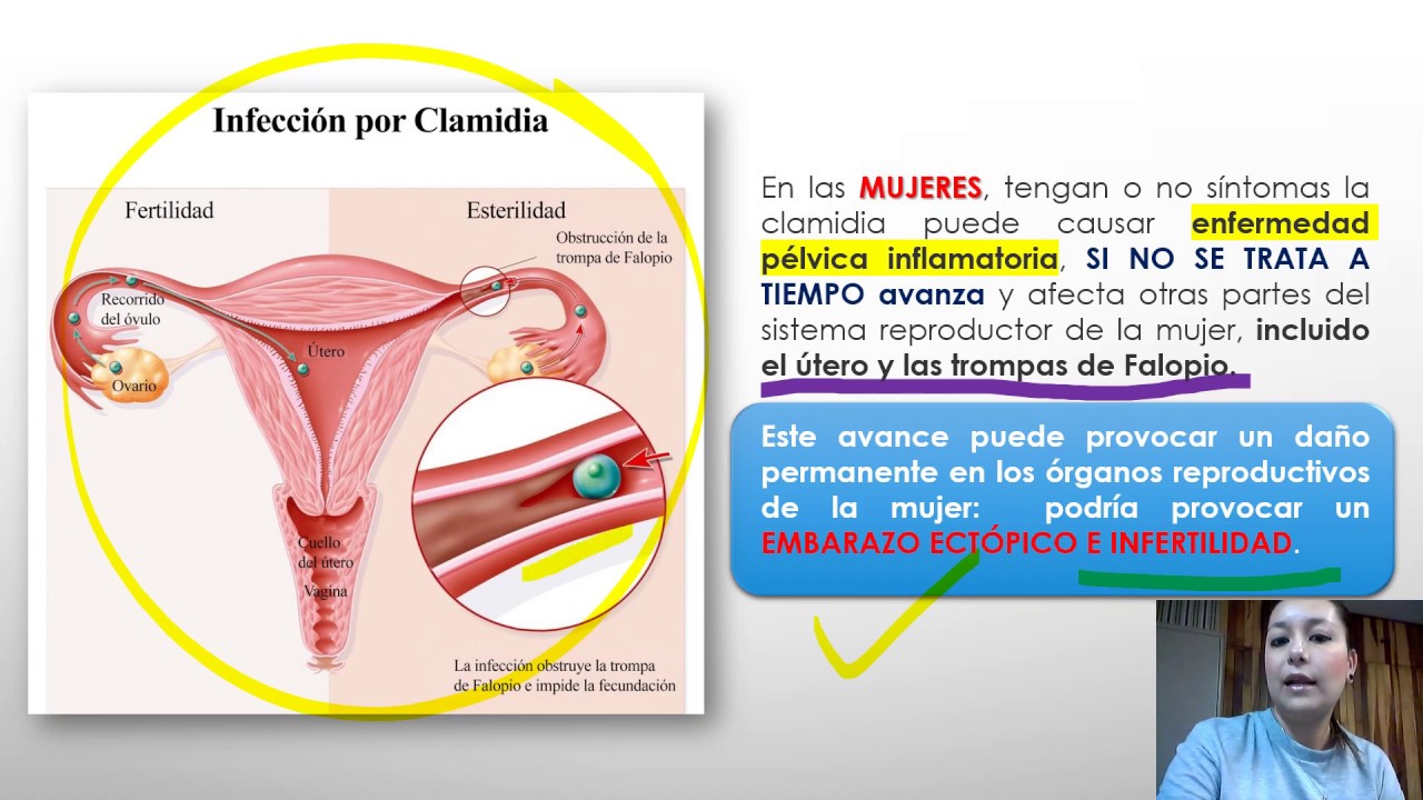 Enfermedades de transmisión sexual