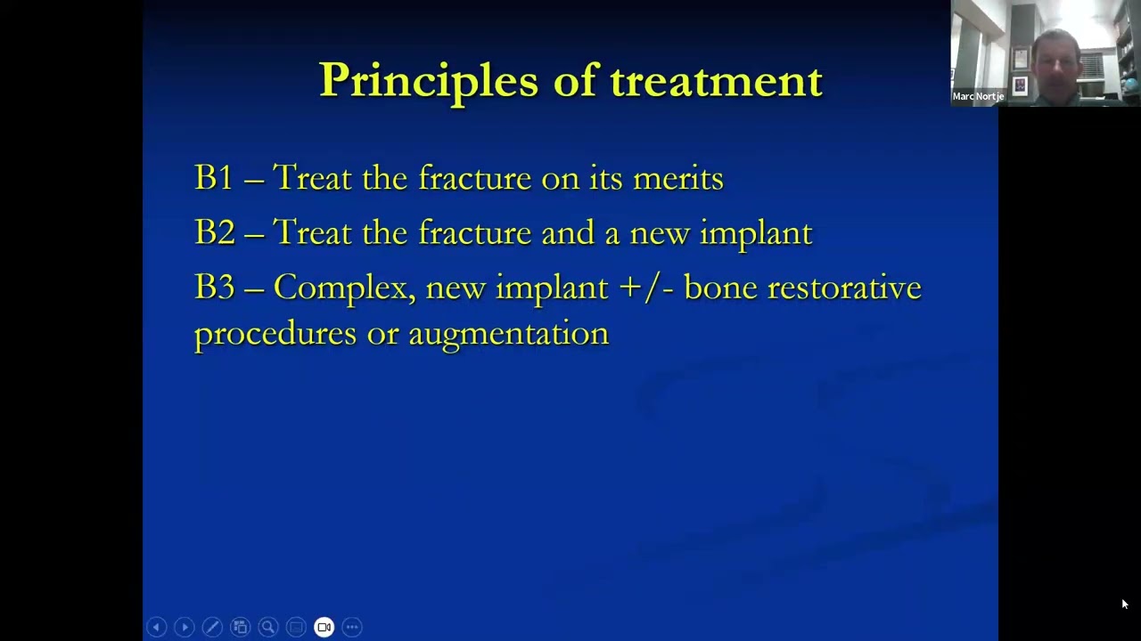 Marc Nortje- Peri-prosthetic fractures involving THR & TKR