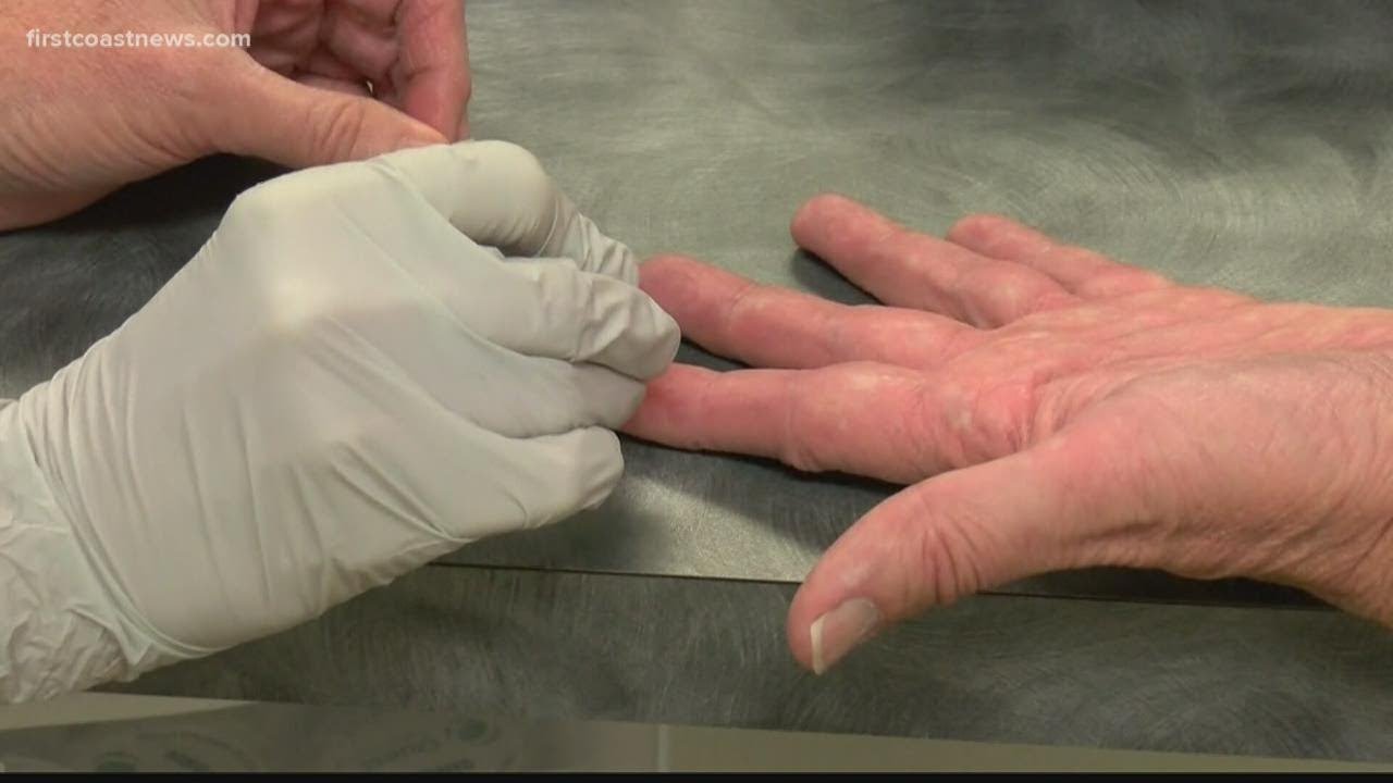 Can you test positive for COVID-19 after being vaccinated?