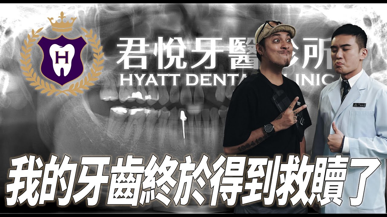 嘎嘎潘俊佳｜基隆君悅牙醫 ！！我的牙齒拯救日記，牙齒弄的好，帥氣沒煩惱！