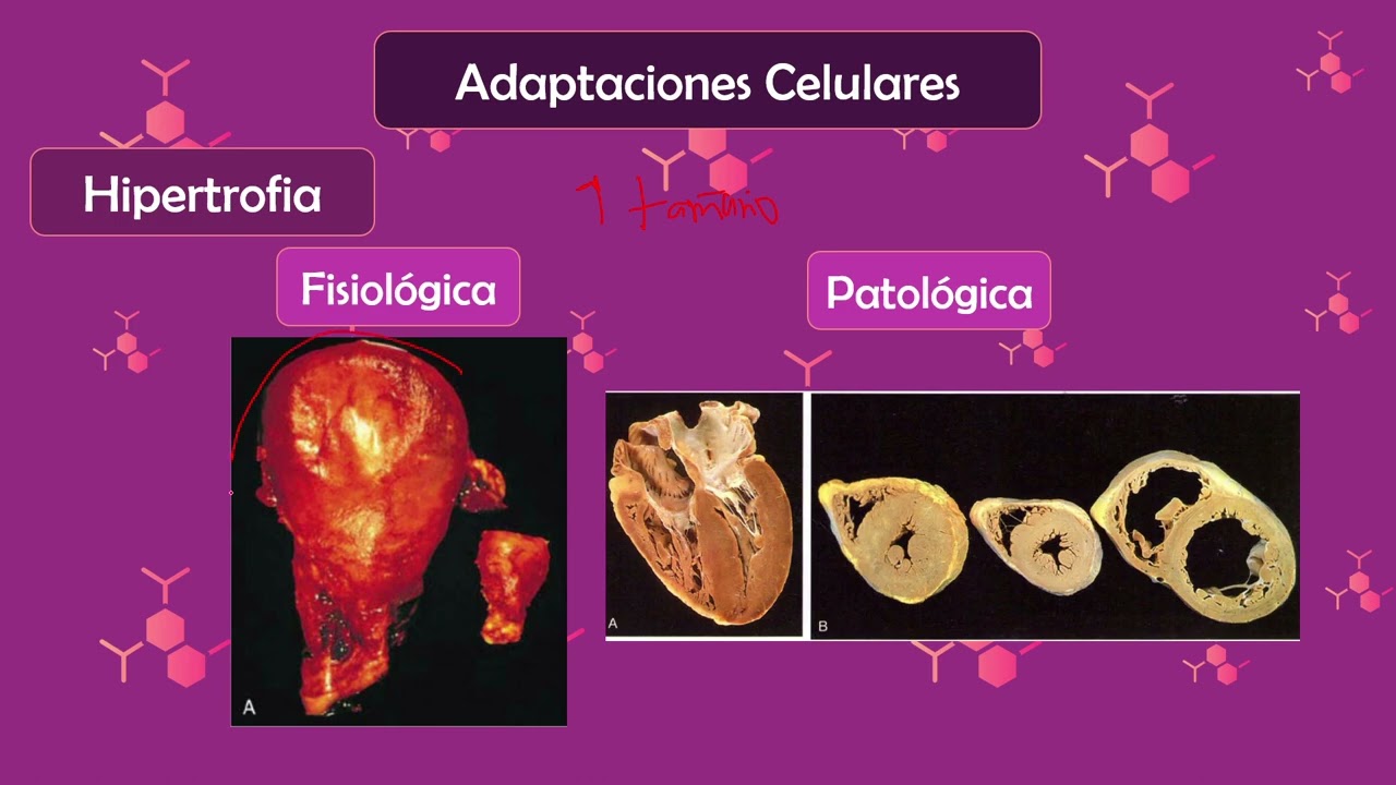 Lesión Celular Patología Introducción