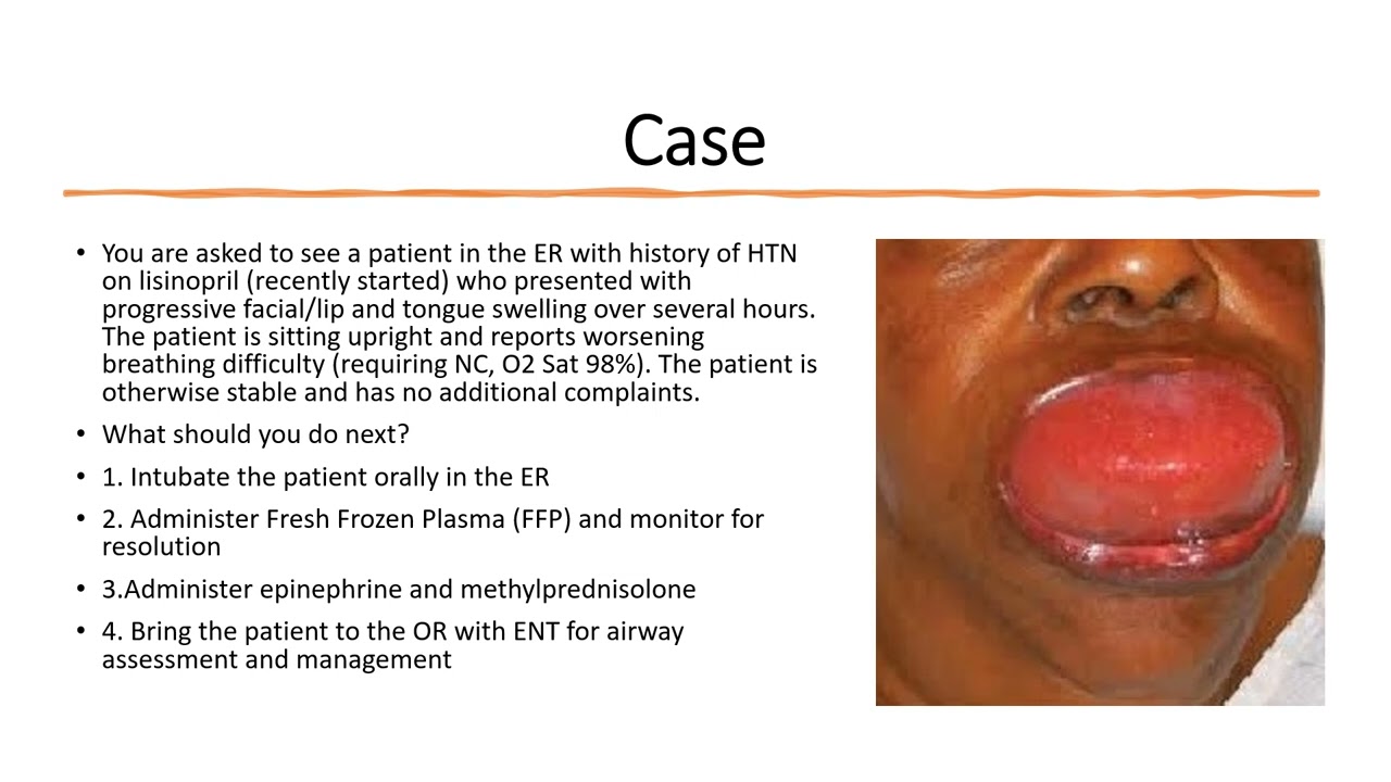 Non-Histamine Mediated Angioedema - (Dr. Mirrakhimov)