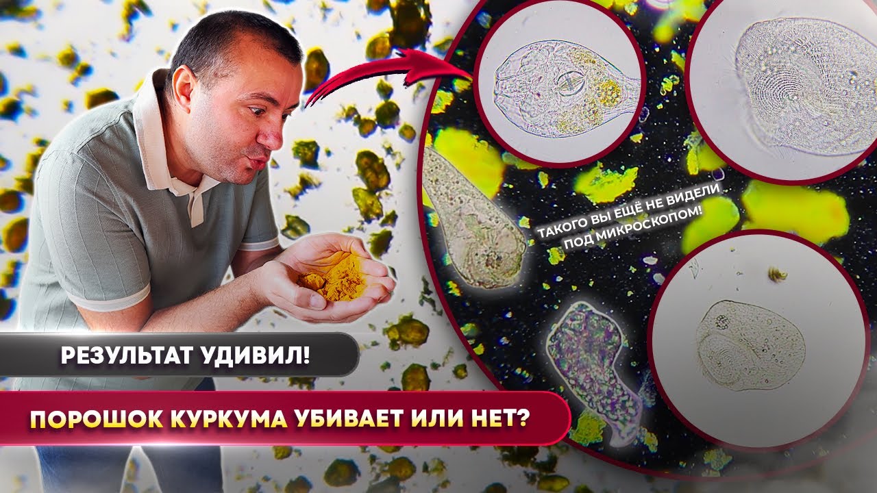 Куркума под микроскопом - убьёт ли порошок микробов? ТЕСТ, о котором вы просили!