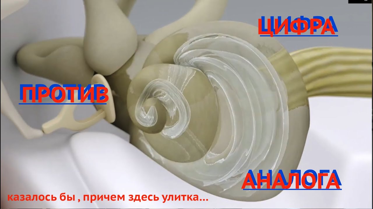 Цифра  против  аналога? Или  вместе...улучшено  #источникзвука21века